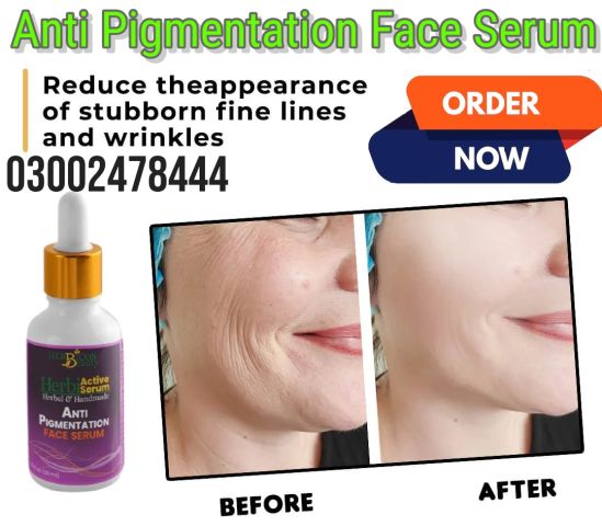 Anti Pigmentation Face Serum In Pakistan- 03002478444 3