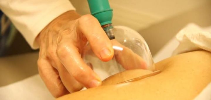 حجام بالرياض|حجامه بالرياض|حجام ممتاز|أفضل حجامة أبوياسين 0535525 3