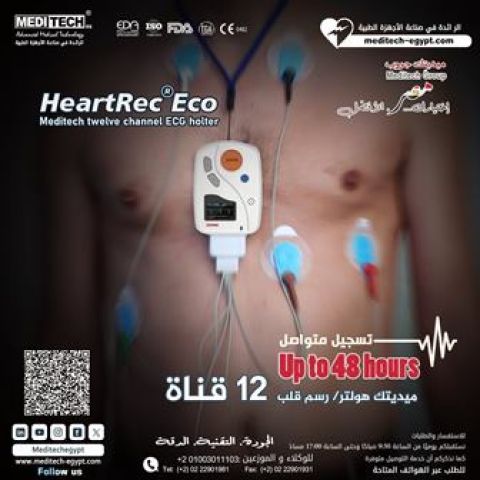 هولتر48ساعه 4